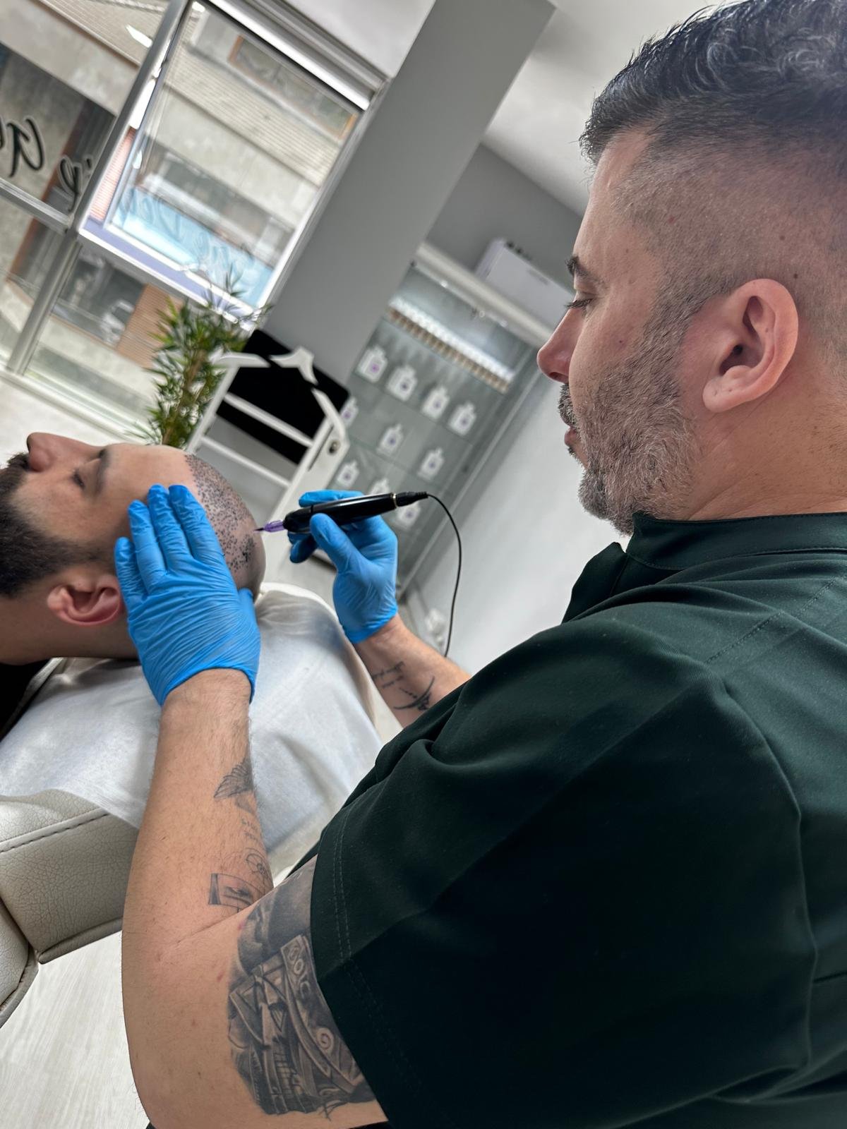 Serkan Bozkurt saç çizgisi üzerinde saç simülasyonu pigment uygulaması yaparken